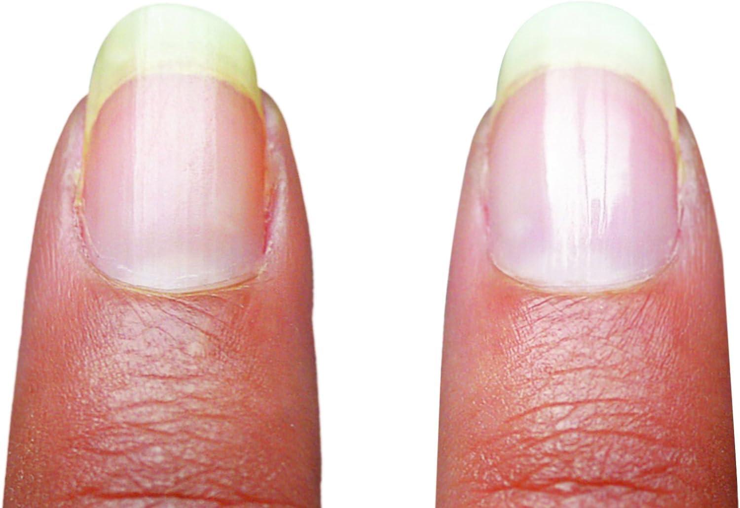 Emjoi Emjoi Micro Nail Manicure or Mani Pedi--Smooths, Buffs & Shines Instantly