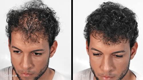 MAXX PRO-SERIES MAXX PRO-SERIES Volumizing Hair Fibers with real Keratin for Thinning Hair/Hair Loss – Dermatologist Tested and Certified Hypoallergenic - 60 days + supply - Multiple Colors Available (Dark Brown)