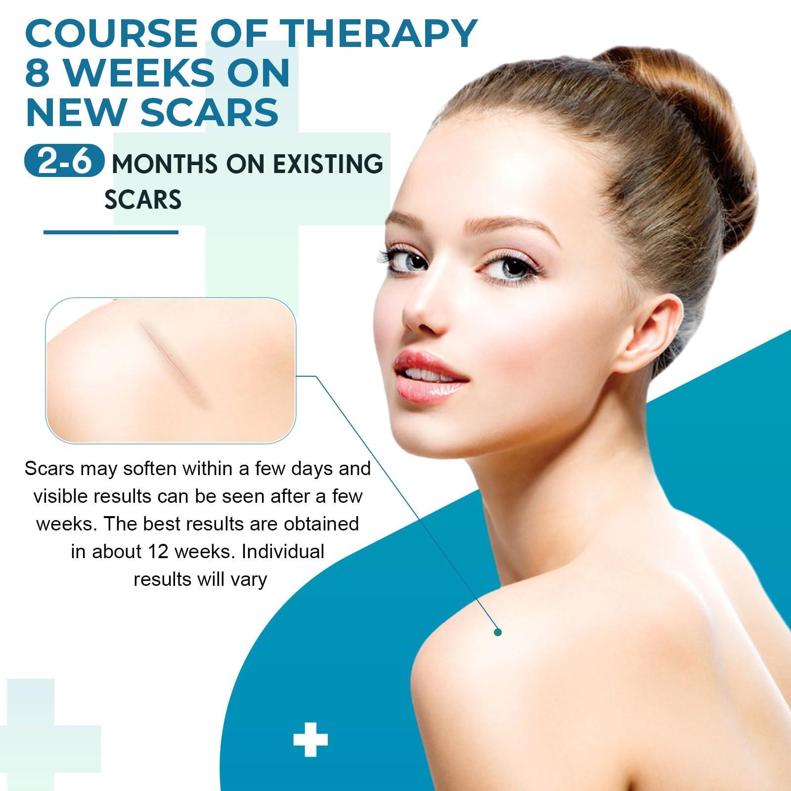 Rvlaim Silicone Scar Sheets, Silicone Scar Tape(1.6x 120 Roll-3M), Silicone Scar Strips, Professional Scar Removal Sheets for Surgical Scars, Keloid, C-Section, Burn et