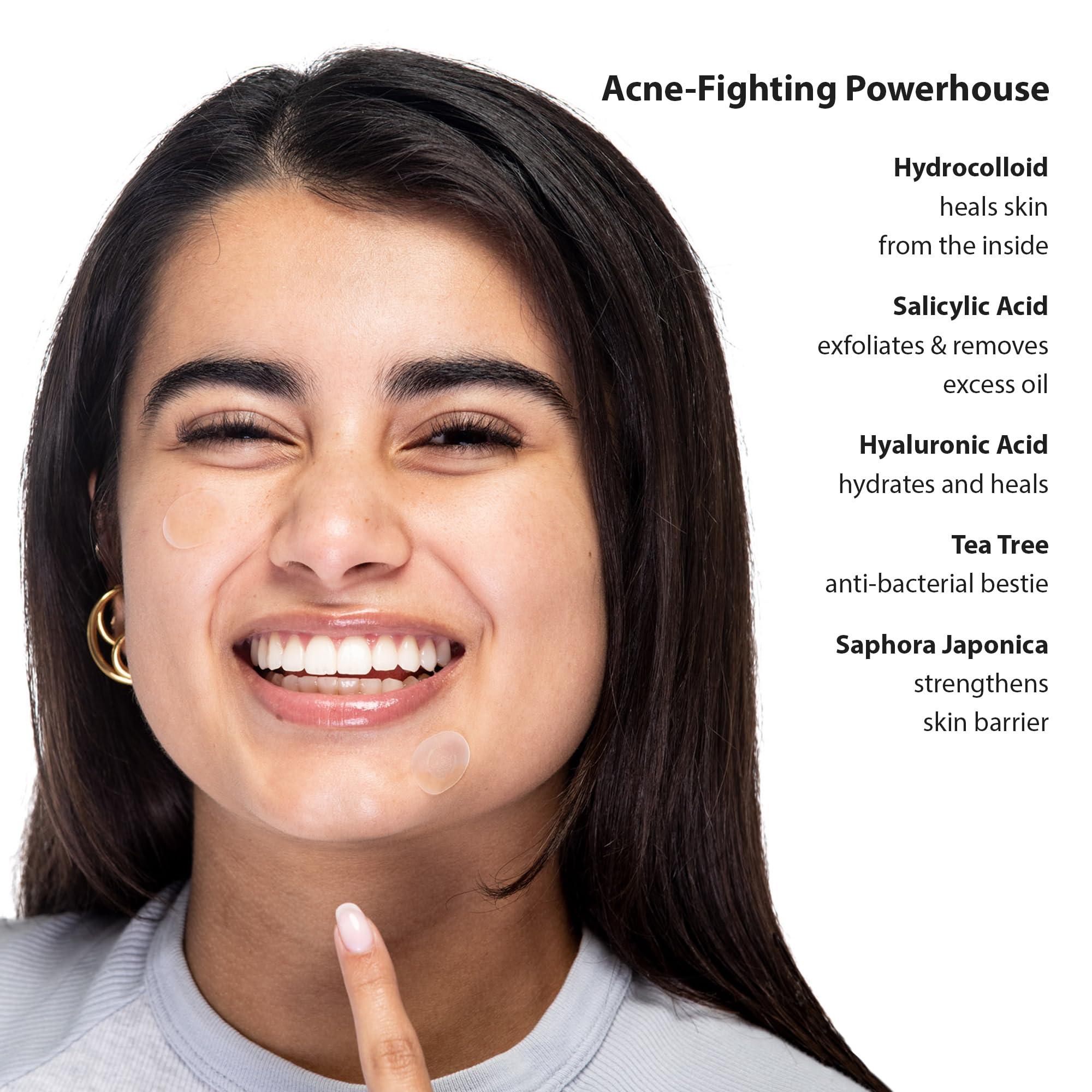 Frilliance Frilliance Microdart Hydrocolloid Acne Pimple Patches for Zits and Blemishes (4 count) Spot Treatment Stickers for Face & Skin, Vegan and Cruelty Free (Deep Dive Micro Darts)