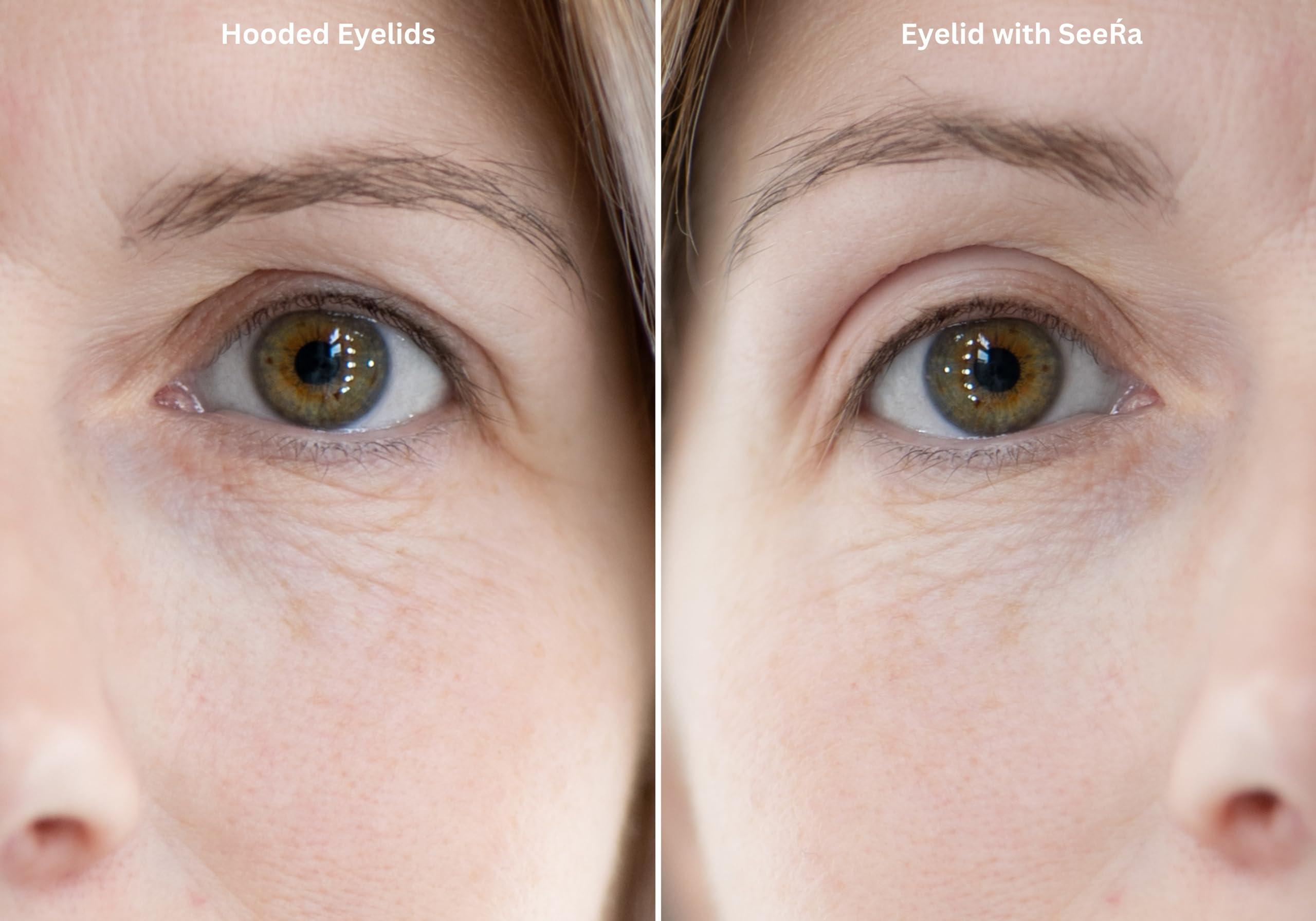 SeeRa SeeRa: Instant Lifting Eyelid Tape for Hooded & Droopy Eyes - Hypoallergenic, Waterproof, Invisible Eye Lift Strips, Non-Surgical, Eyelid Lifters & Stickers (4mm-7mm) (5mm-Intermediate)