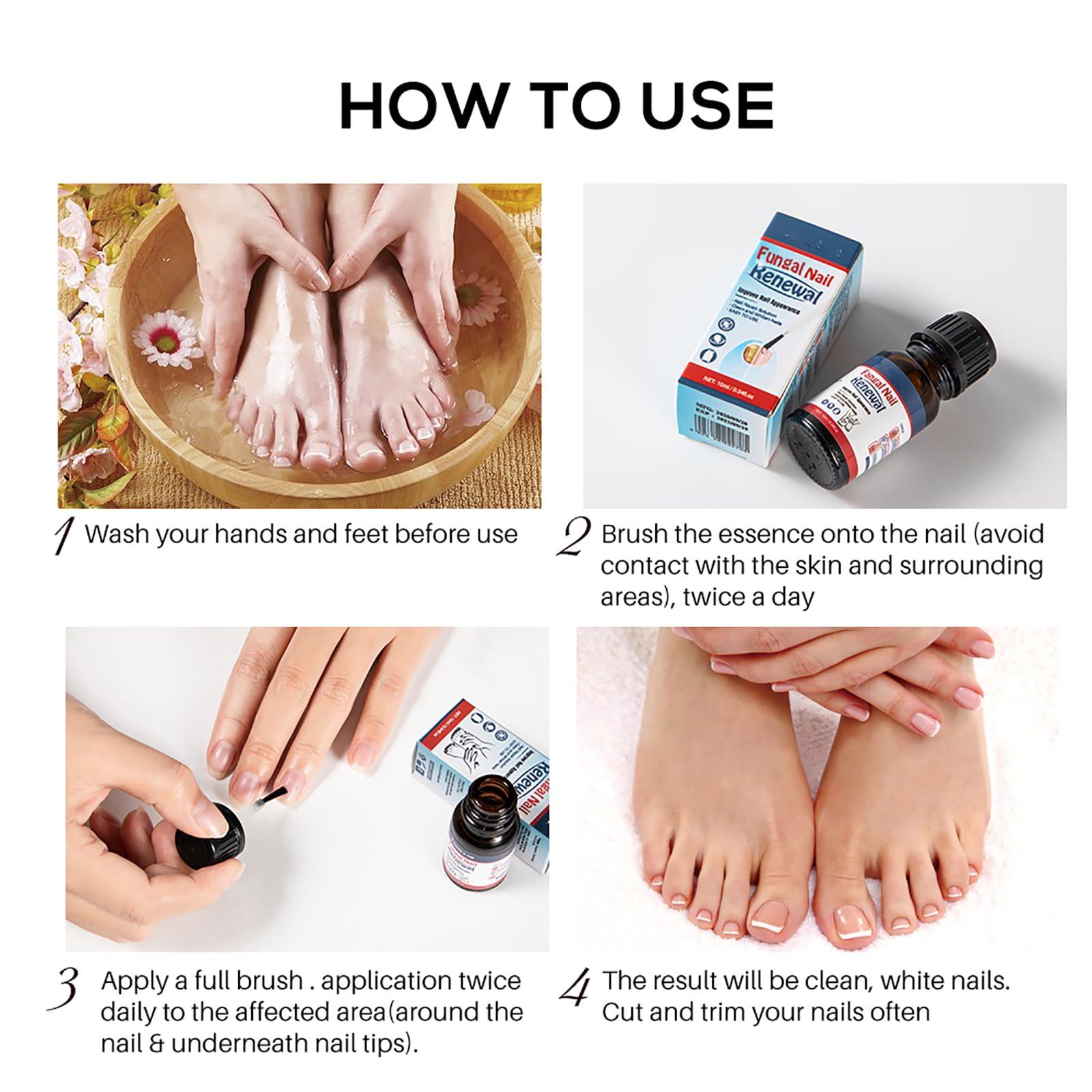 Easilydays Easilydays Nail Repair Essnce Liquid, Fingernail and Toenail Repair, Fix & Renew Damaged, Broken, Cracked & Discolored Nails, Reduce Nail Thickening, Strengthen Nails for Beautiful Nail