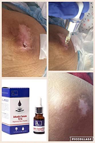 RAVIAD Natura Resort AMAZON Arkada TC16 Serum