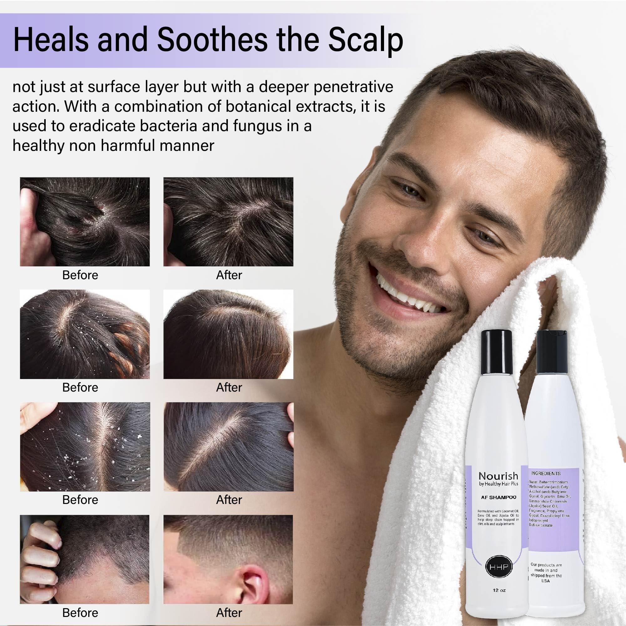 Healthy Hair Plus Fungus Shampoo & Conditioner Set for Humans - Relieves Itchy Dry Scalp, Reduces Inflammation & Irritation. Emu Oil for Gentle Cleansing, Non-Greasy for Women & Men. Made in the USA by Healthy Hair