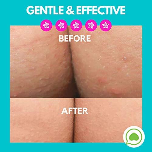 Green Heart Labs Brilliant Booty Kit | Butt Acne Clearing Lotion and ExfoliMATE Magic Body Exfoliating Cloth for Soft & Young Skin (Black)