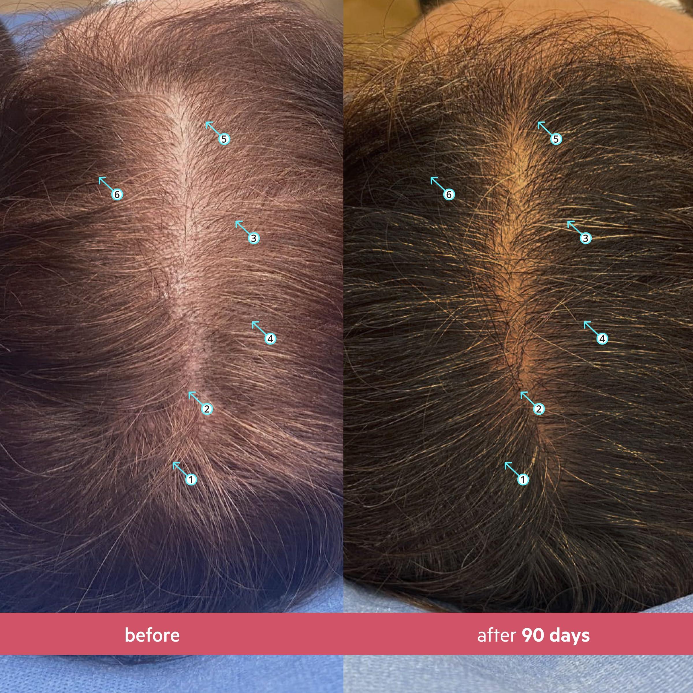 DS Laboratories DS Labs Spectral Women's Formally Spectral.CSF - Hair Density Serum for Women, Thickening, Strengthening, Volumizing, Fuller-Looking Hair, 60mL, Packaging May Vary