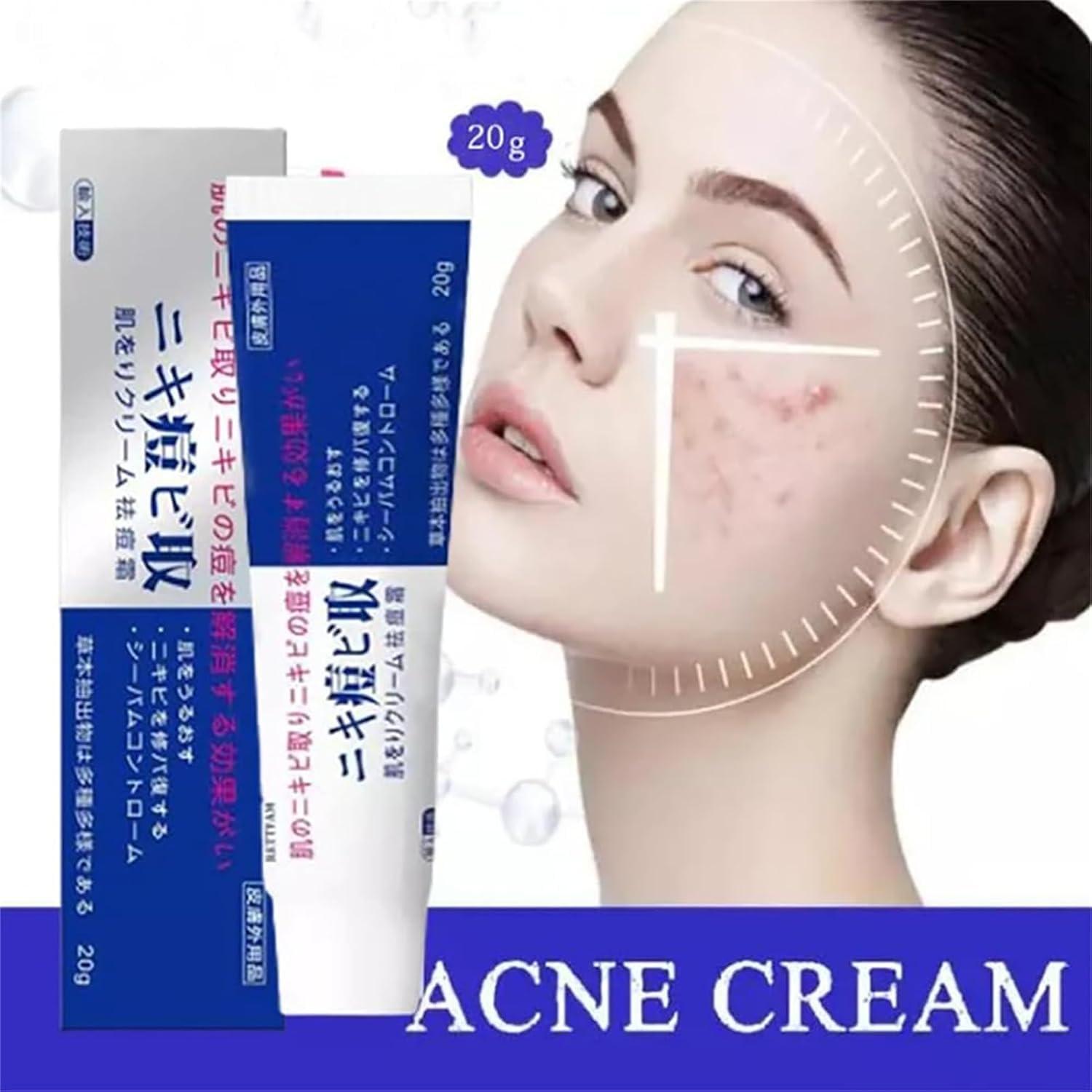 getuse Lion Pair Acne Cream, 20g | Natural Acne Gel for Face | Japanese Moisturizing Treatment for Women & Men | 3pcs (1pc)