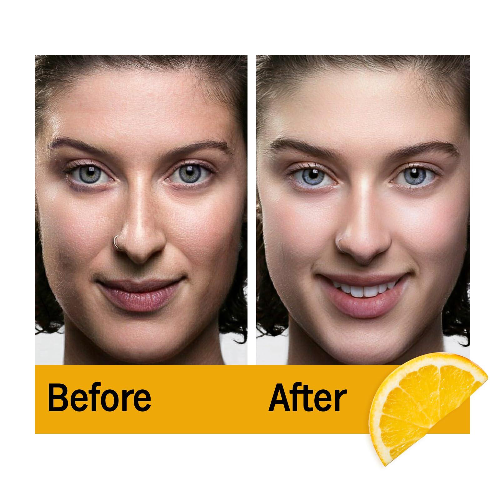 Skincyclopedia Skincyclopedia Facial Serum Treatment Set, 1 Vitamin C Face Serum +1 Hydrogel Eye Patch, Brightener, Reduces Dark Spots, Boosts Natural Collagen, Improves Skin Texture, Oil Control, Deep Hydration.