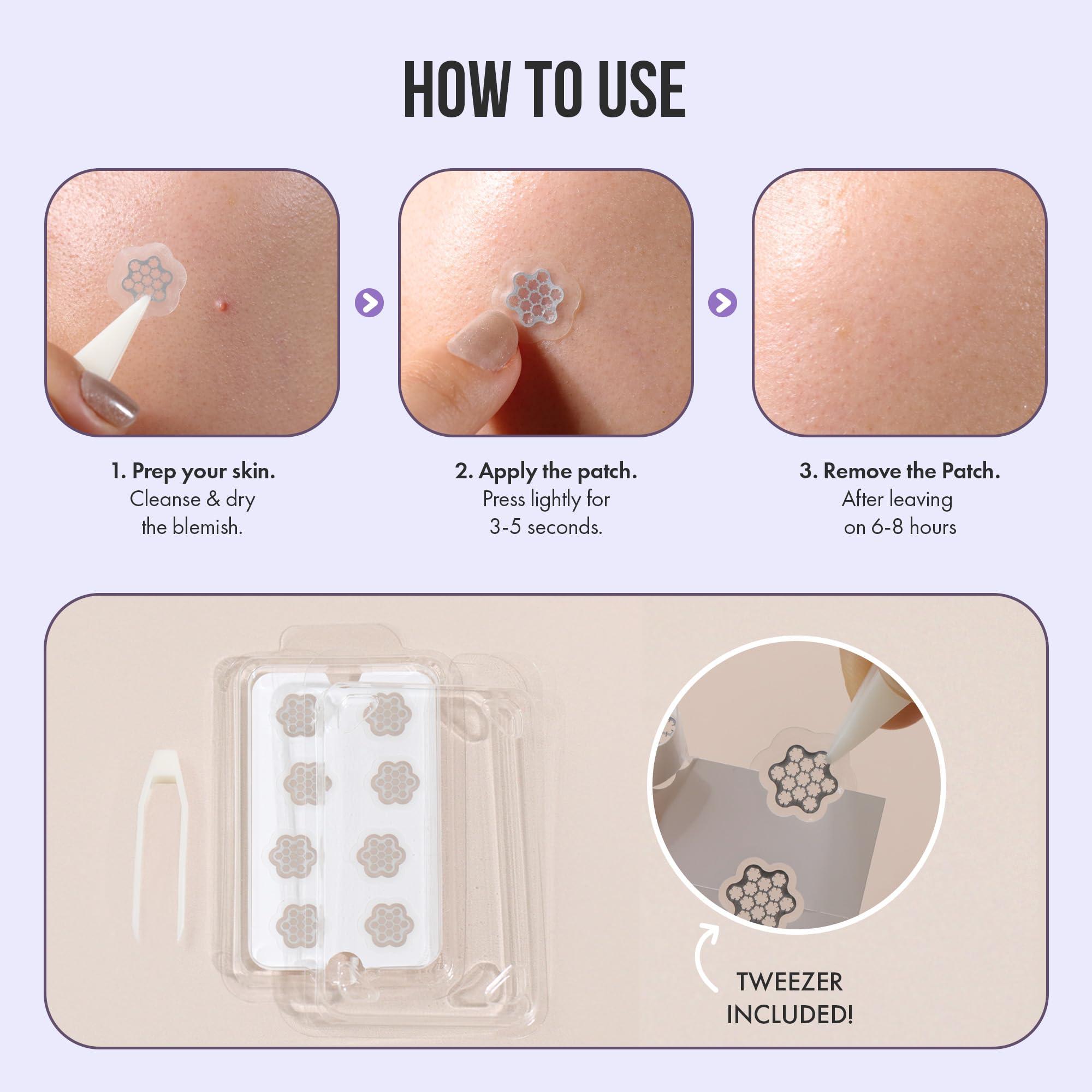 FreeGo Deep Blemish Microdarts | Pimple Patch | Cystic Acne | Fast-Acting | Quick Calming | 99.9% Pure Magnesium | Madecassic Acid | Tea Tree | Eucalyptus Leaf | Hydrocolloid Spot Care