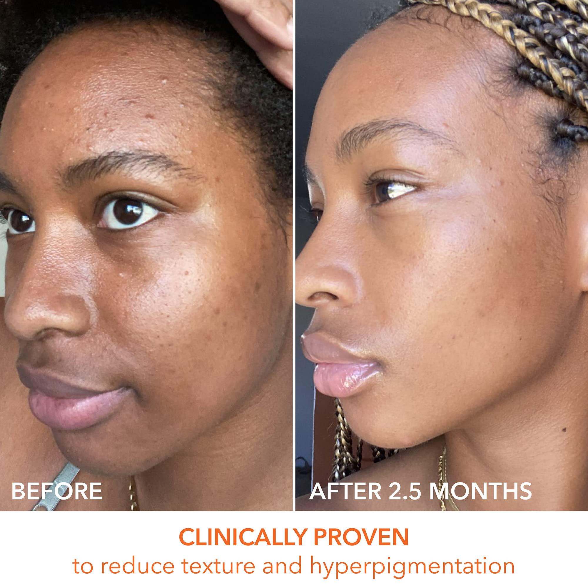 Dr Dennis Gross Alpha Beta Universal Daily Peel by Dr. Dennis Gross for Unisex - 60 Pc Pads