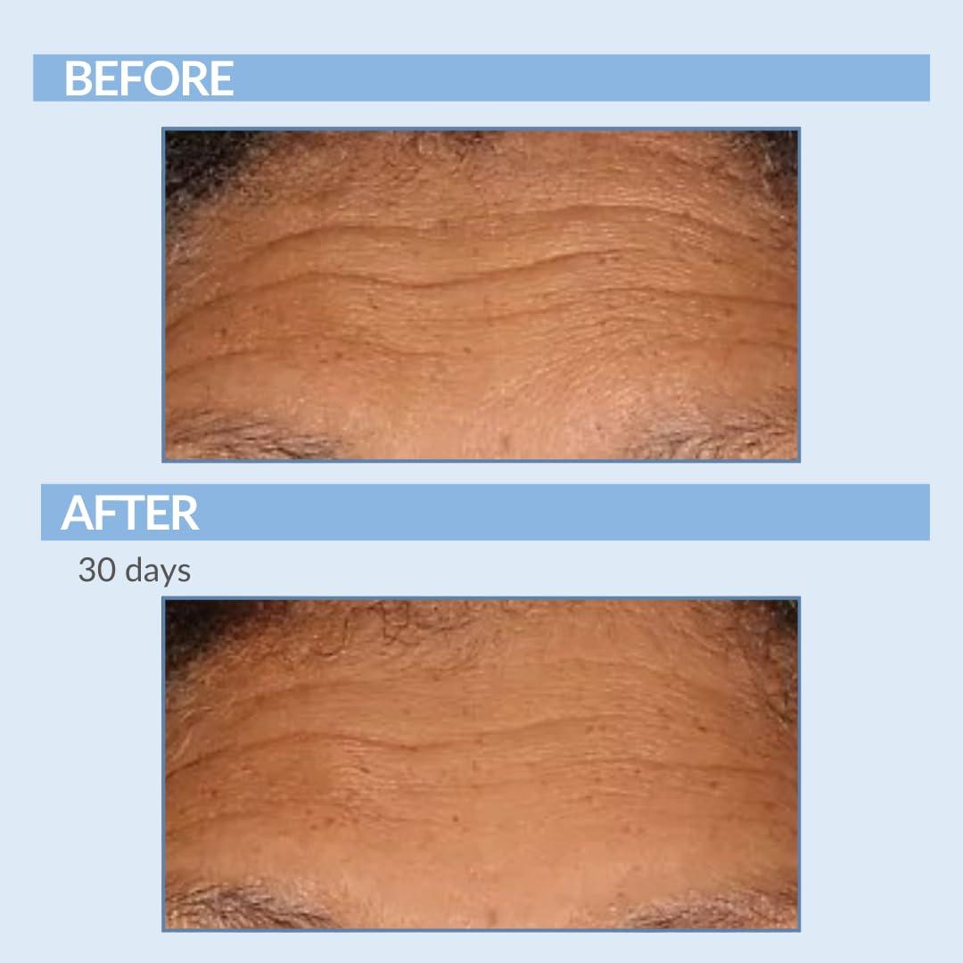 Serious Skincare Serious Skincare Retinol Facial Care DUO - A Force XR Serum Concentrate & A Cream XR Moisture Cream for Face - With Vitamin C - Anti-Aging for Lines, Wrinkles - Resurfaces and Hydrates Skin