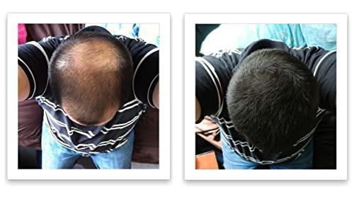 Caboki Caboki All-Natural, Plant-Based Hair Concealer Covers Bald Spot and Thinning Hair. (16G, 40-Day Supply). Black