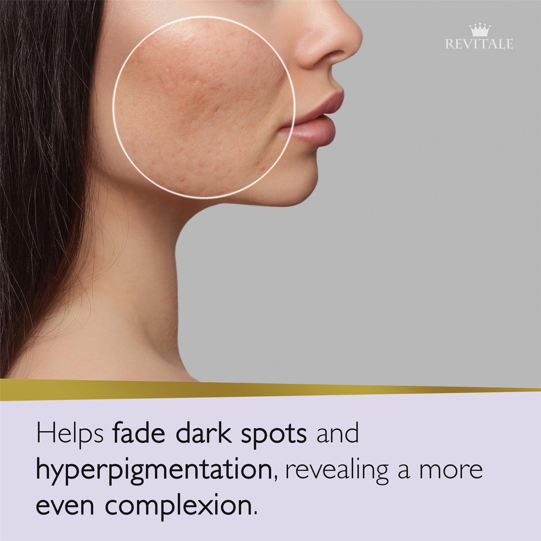 REVITALE Revitale Advanced Azelaic Acid and Niacinamide Soap