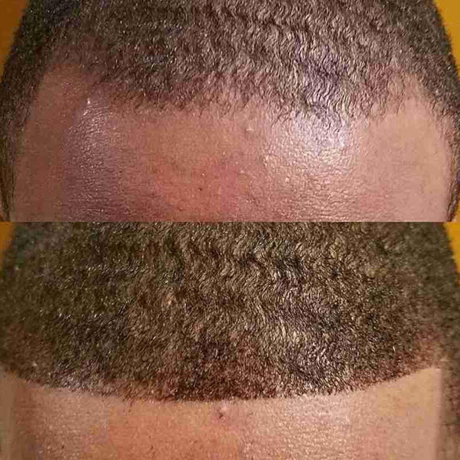 Luzhengyang Luzhengyang Premium Hairline Counter Thickening Concealer Powder - Covers Bald Spots, Thin Hair, Beards - Natural Look - 12g Net Content - black