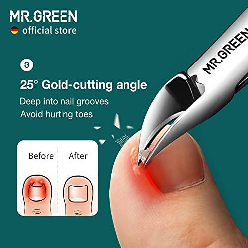 MR.GREEN MR.GREEN Nail Clippers Toenail Cutters Anti-Splash Professional Ingrown Thick Hard Nail Scissors Pedicure Tools Manicure Sets (Blue Handle)