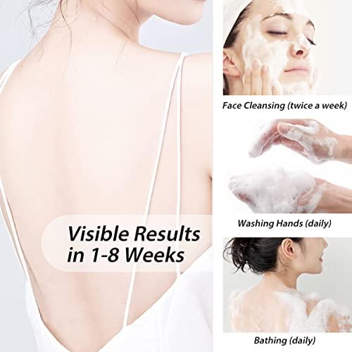 Bee & Flower Bee & Flower Shanghai Sulfur Soap 10% Sulfur Soap Face and Body Bar Soaps 3.4 Oz (6 Packs)