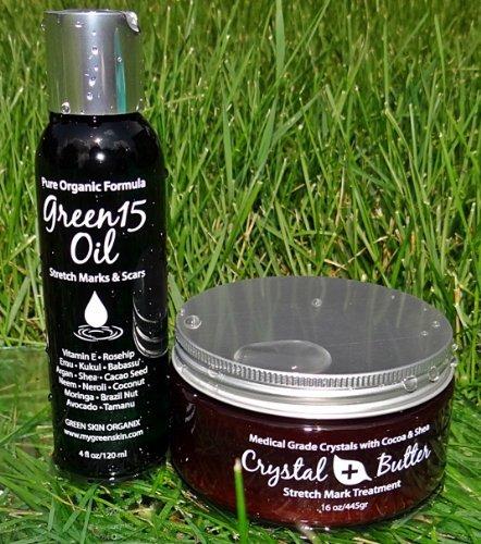 Green Skin Organix Best STRETCH MARK Complete Solution Kit- Medical grade microdermabrasion crystals mixed with Raw Cocoa Butter +organic 15 natural oils blend Stretch Mark COMPLETE KIT Microdermabrasion Crystal Butter & Green15 Oil shown to prevent and remove old stre