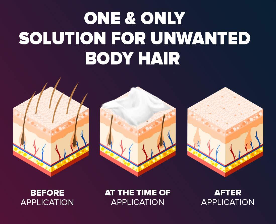 epify by bubbly Epify Intimate Hair Removal Cream for Men and Women - Sensitive Skin, Pubic & Bikini Areas (Pack of 3)