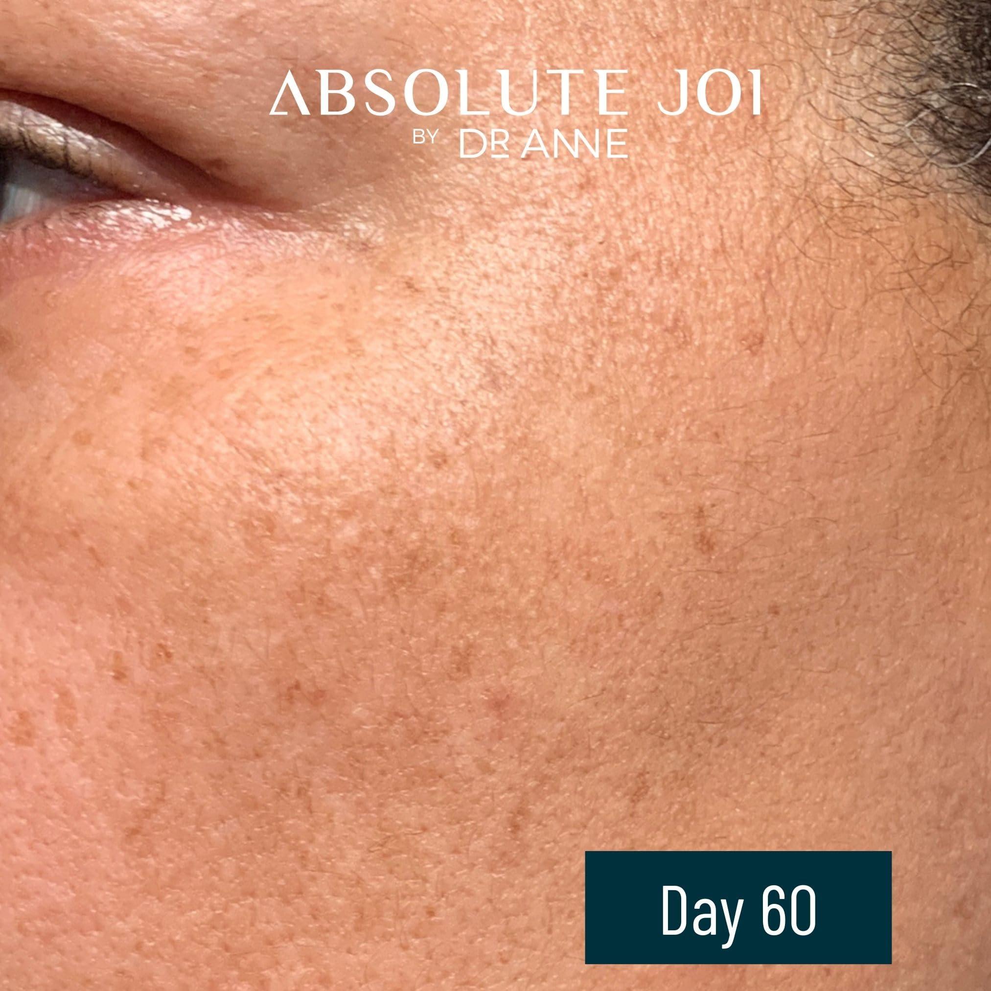 AbsoluteJOI Retinol Plus Vitamin C Skin Refining Night Oil for Fines Lines and Hyperpigmentation with Sensitive Skin Friendly Granactive Retinoid - Unscented - 1 Fl Oz Full Size