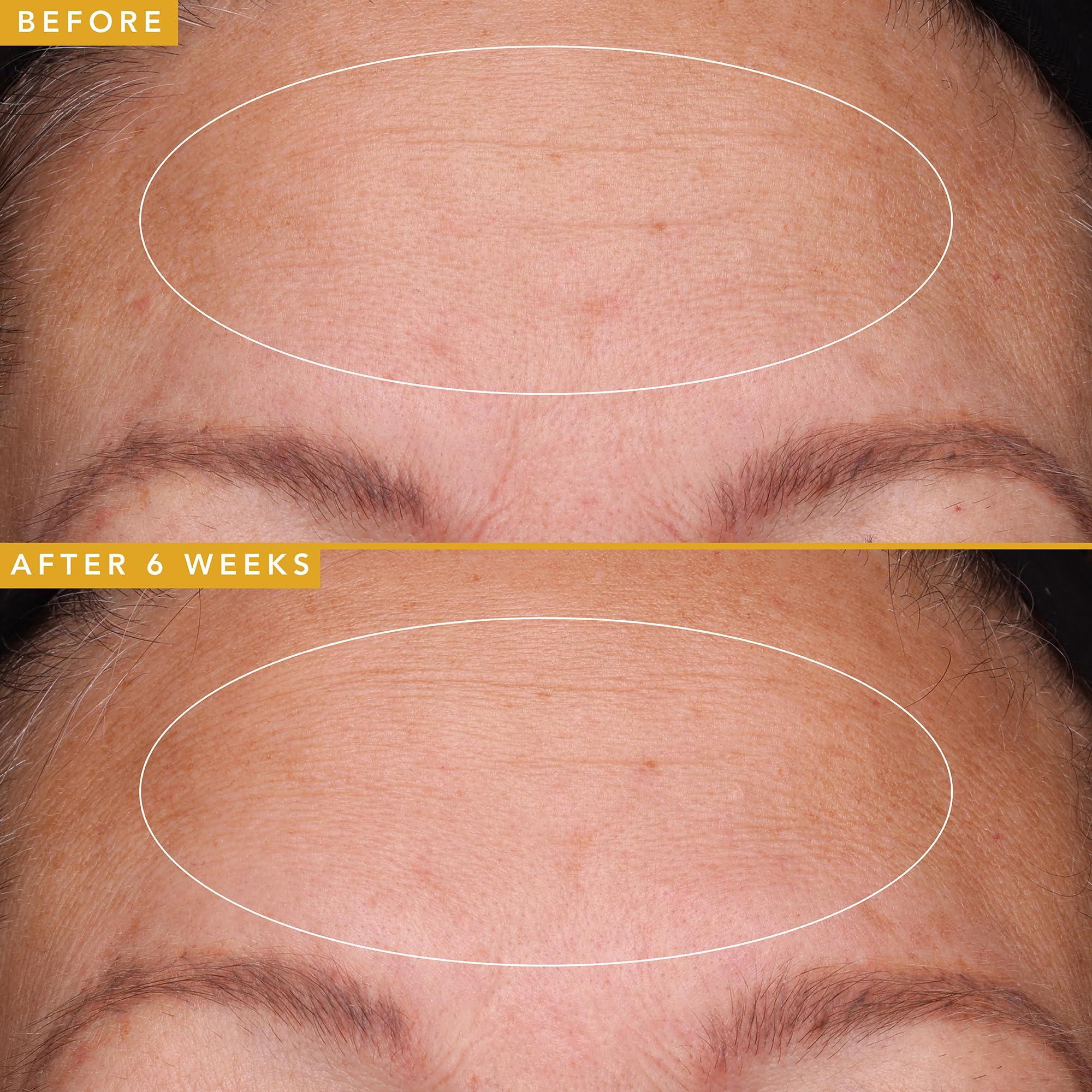 Farmacy Farmacy Filling Good Hyaluronic Acid Serum for Face - Anti Aging Skin Care + Hydrating Face Serum - Plumps, Smoothes & Helps to Visibly Improve Skin Firmness for a Youthful Complexion (5ml)