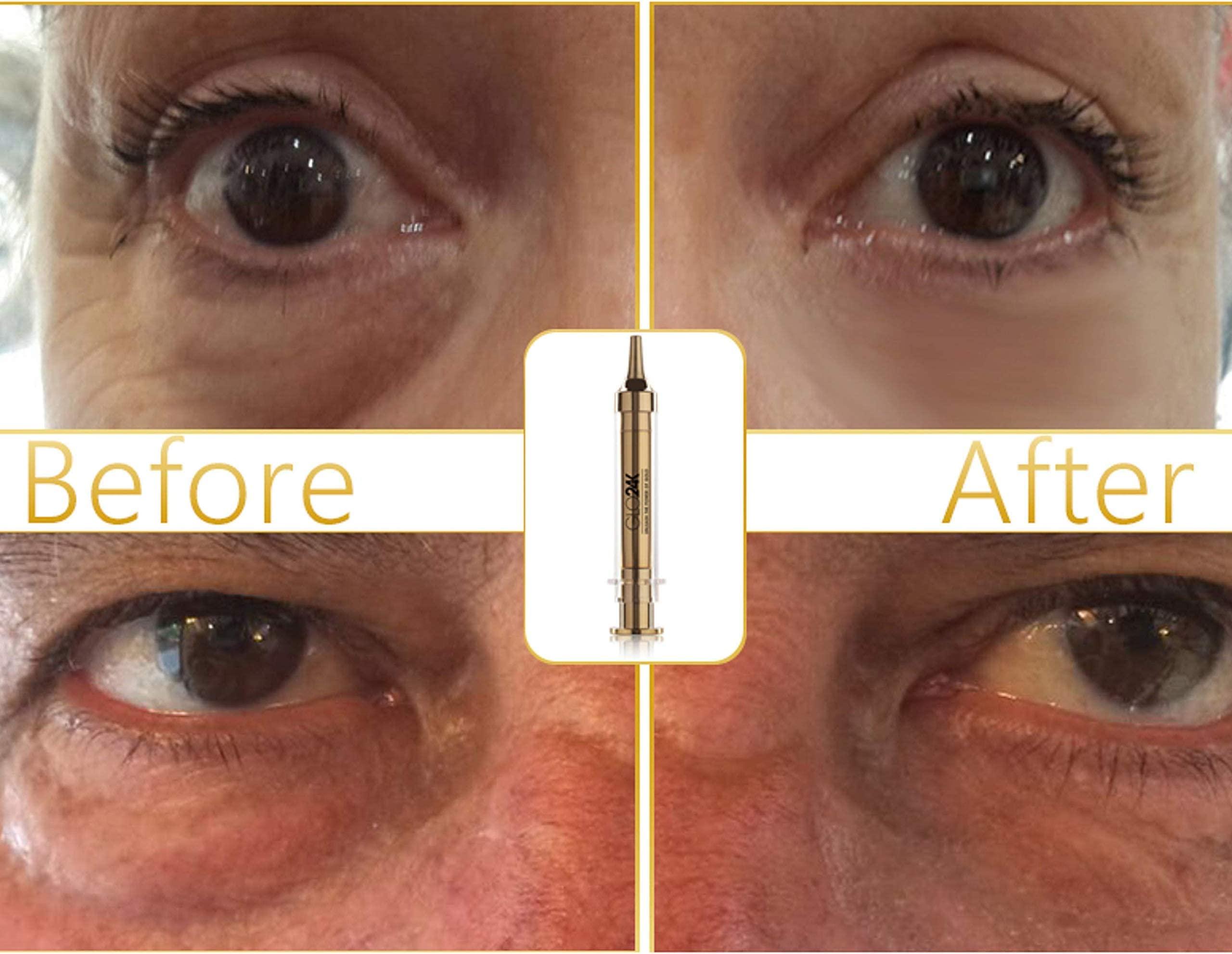 GLO24K UNLEASH THE POWER OF GOLD GLO24K Complete Eye Care Set with our 24k Instant Facelift Cream, Eye Cream, and Eye Serum