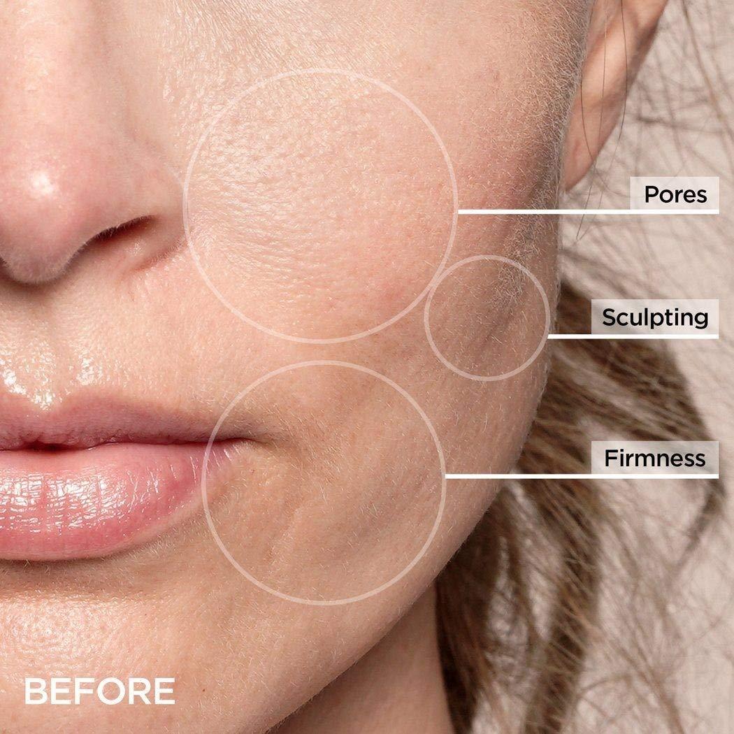 Beauty Bioscience BeautyBio GloPRO Cryo Roller Duo: Skin Icing Attachment Head For Eyes, Face and Body. Sculpts, de-puffs, tightens pores and regulates oil