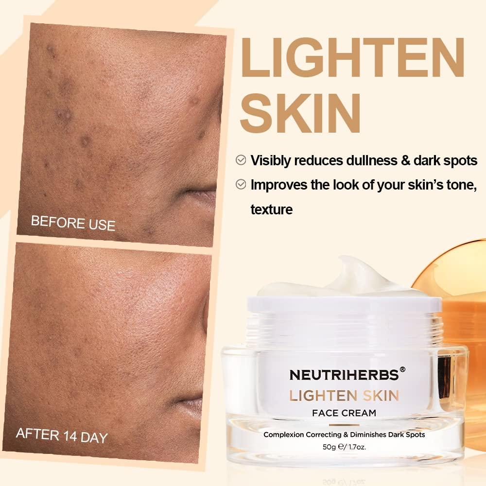 Neutriherbs Neutriherbs Dark Spot Remover Corrector, Skin Lightening Cream, Skin Bleaching for face, underarms, elbows&privates, with Vitamin C, Symwhite 377, Ideal for Face Moisturizer Cream 50g/1.7oz