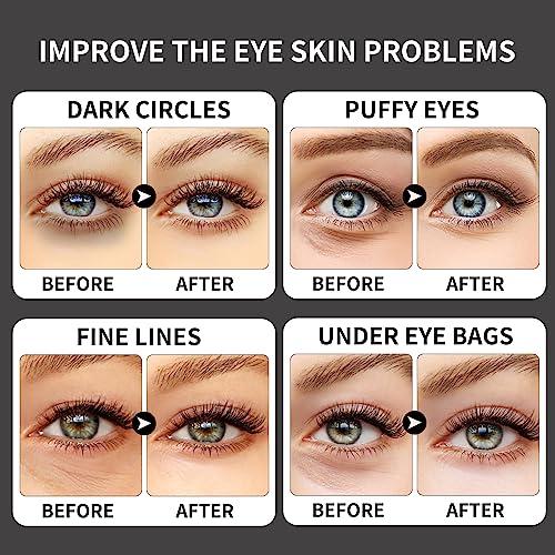 ROUSE ROUSE Collagen Under Eye Patches with Caffeine Eye Treatment Mask for Dark Circles Eye Fatigue Puffiness Refreshing Revitalizing Skin Care Eye Gel Pads-20 Pairs