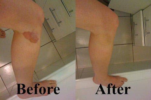 Hide Ink Hide Ink Temporary Tattoo Cover Up 4" x 6" - LITE COLOR (5-Pack)