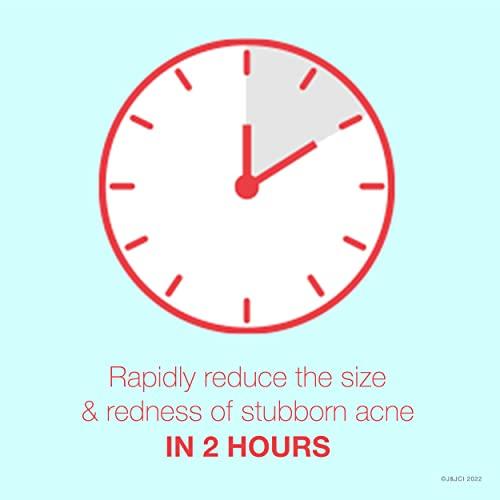 Neutrogena Neutrogena Rapid Clear Stubborn Acne Spot Treatment Gel with Maximum Strength 10% Benzoyl Peroxide Acne Treatment Medication, Pimple Cream for Acne Prone Skin Care, 1 oz