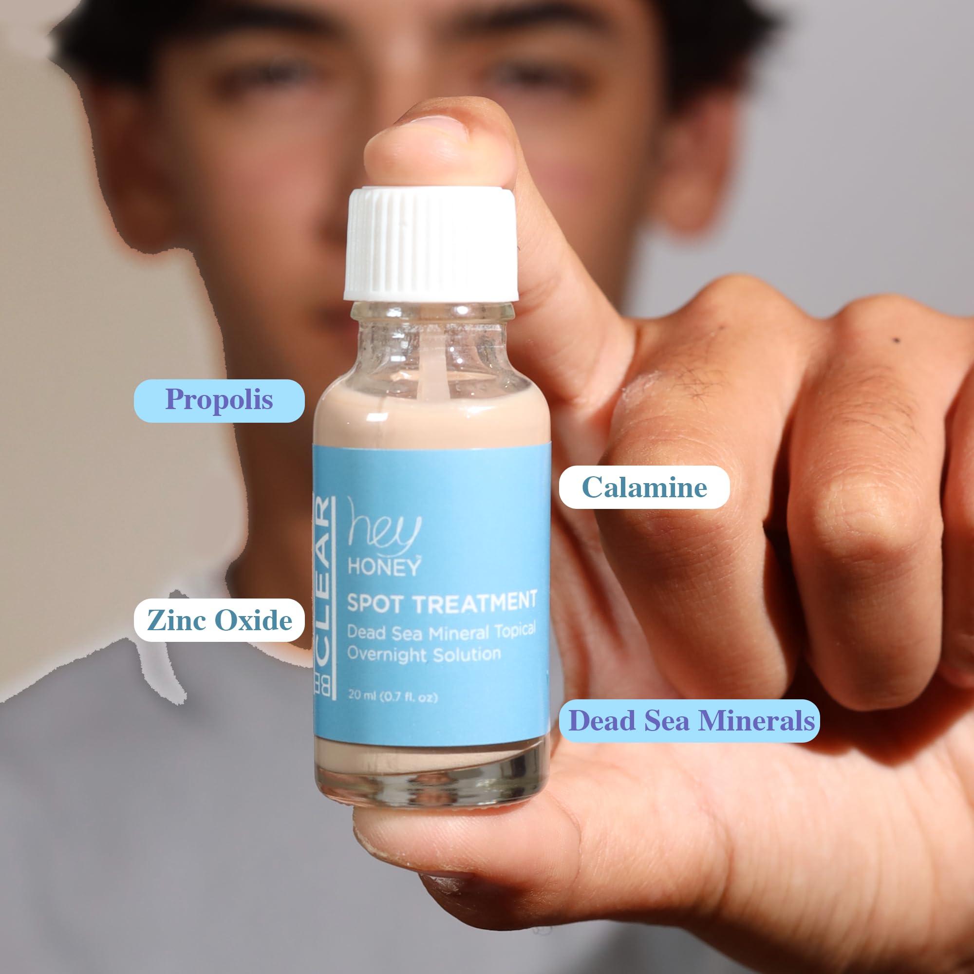 Hey Honey Hey Honey Skincare Be Clear - Acne Spot Treatment Overnight, Pimple Drying Lotion, Use Over Zits Whitehead & Blemishes 1 OZ