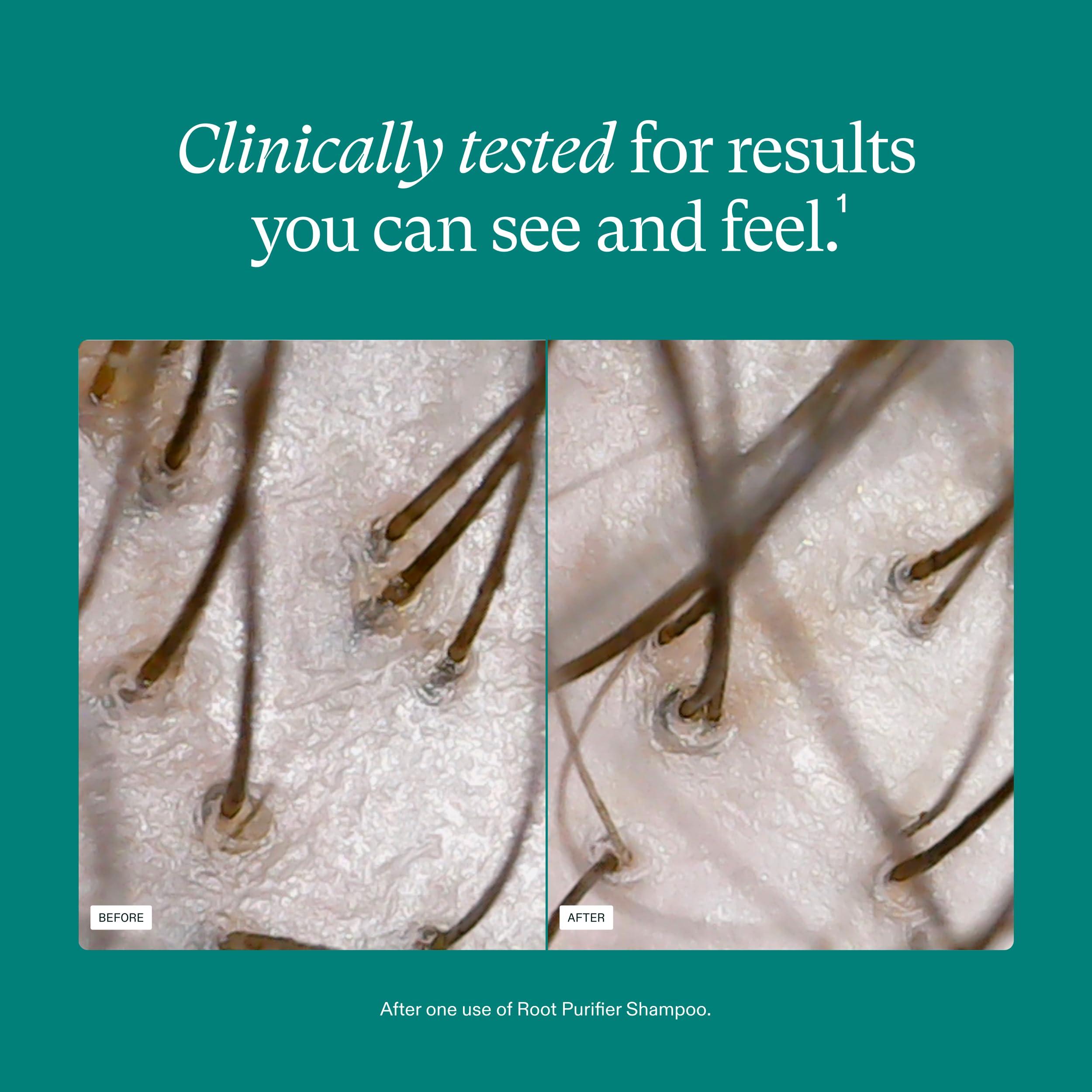 Nutrafol Nutrafol Shampoo, Cleanse and Hydrate Hair and Scalp, Improves Hair Volume, Strength and Texture, Physician-formulated for Thinning Hair, Color Safe, Sulfate Free - 8.1 Fl Oz Bottle