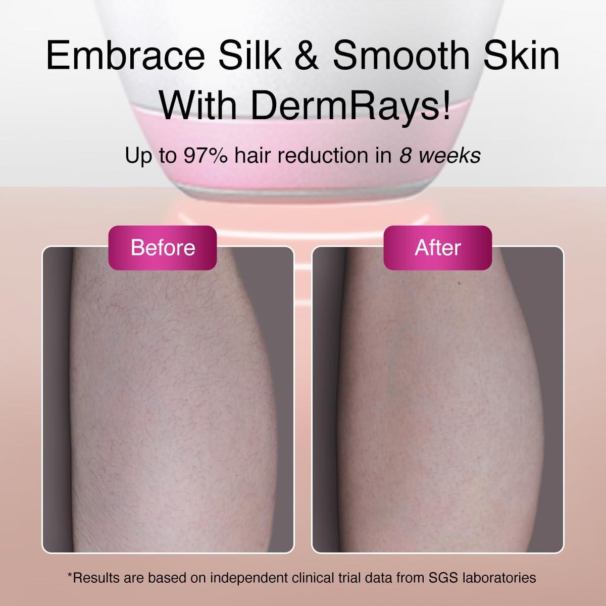 DermRays Upgrated Diode Laser Hair Removal for Dark Skin Tones, DermRays 1064nm Laser Hair Removal, Permanent Reduction in Hair Regrowth for Women and Men, V6S Suitable for Deep Skin Tone