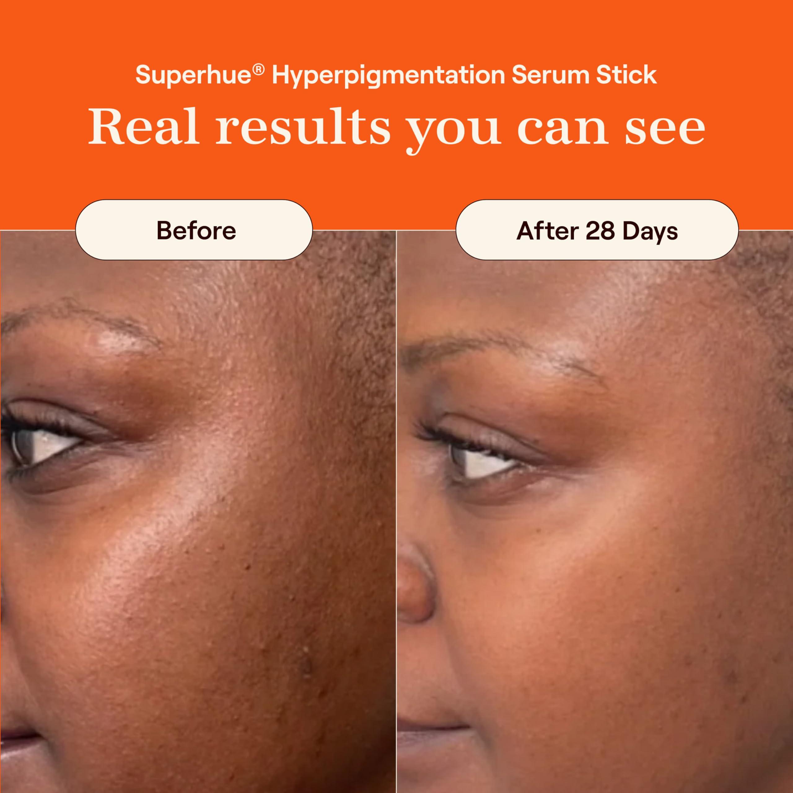 Live Tinted Live Tinted Everything Nice Correct & Protect Duo - Hueguard Invisible Sunscreen Stick SPF 50 & Superhue Hyperpigmentation Facial Serum Stick - Broad Spectrum, Waterproof & Brightening