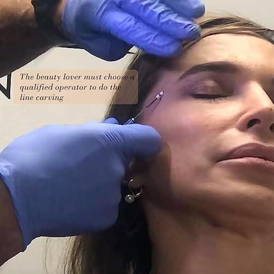 MatYas Pdo Pcl Multi Threads,23G38MM, for Face Lift,Removing Wrinkle Nasolabial L-Type,20pcs (PCL)