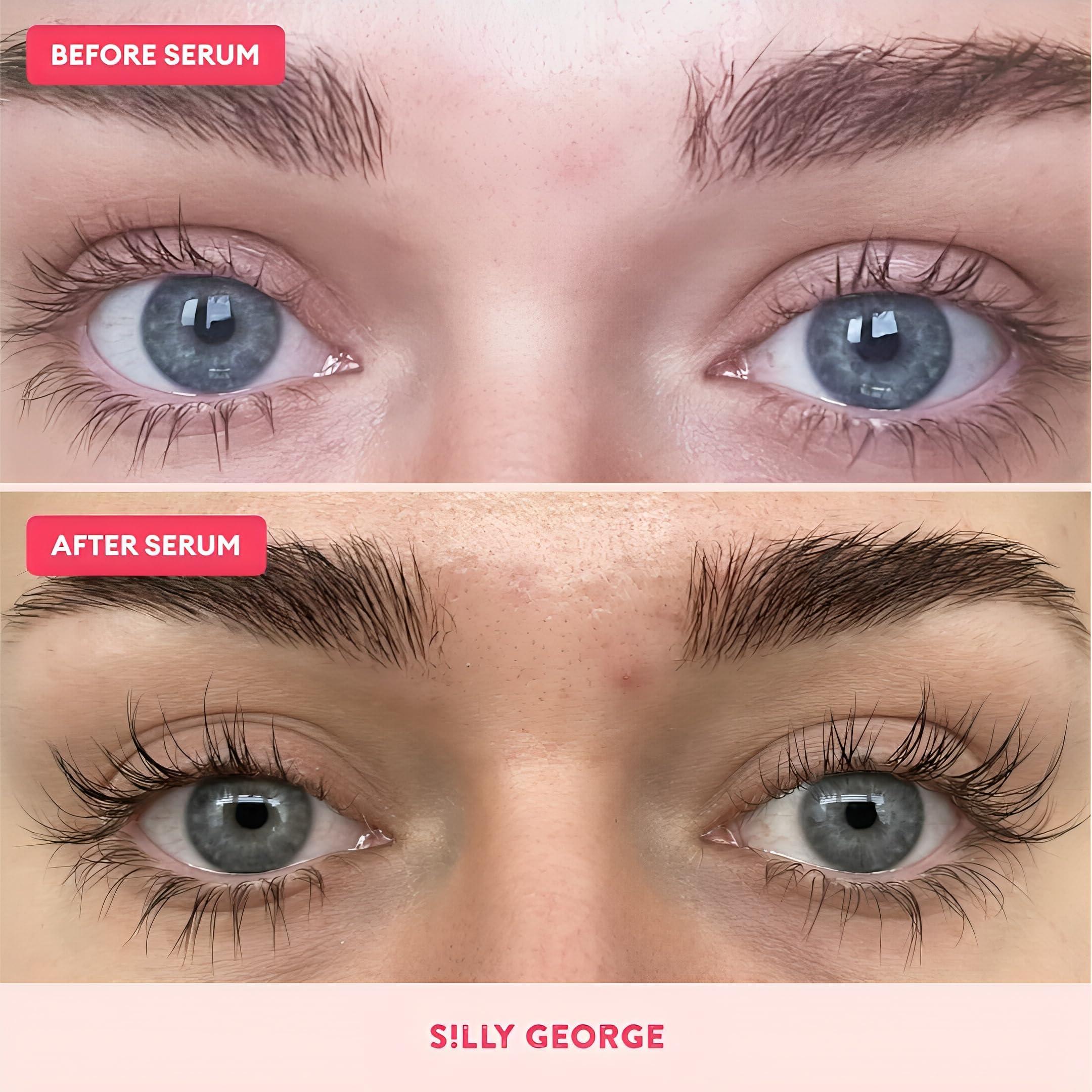 Silly George Silly George Eyelash Growth Serum for Thicker, Fuller, Longer & Bold Eyebrows, Premium Serum, Lashes & Brows Enhancer, (3ml, 0.1 Fl. oz)