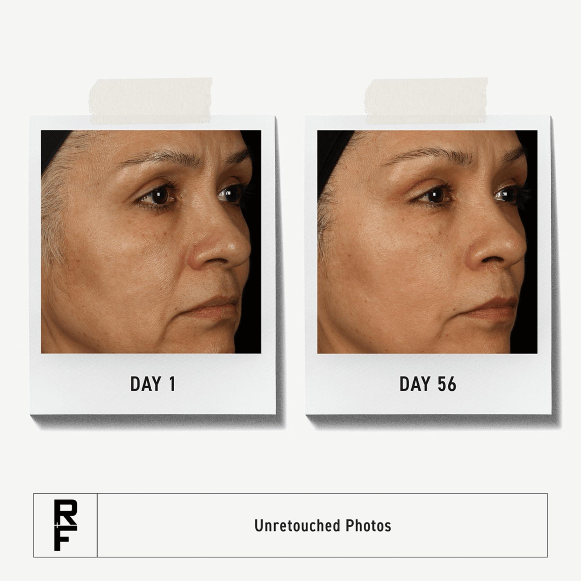 RODAN + FIELDS RODAN + FIELDS Total RF Serum 30 mL | Skincare Serums | Hydration, Anti-Aging for Women | Self-Care | Targets Deep Wrinkles & Fine Lines | Morning & Night Use