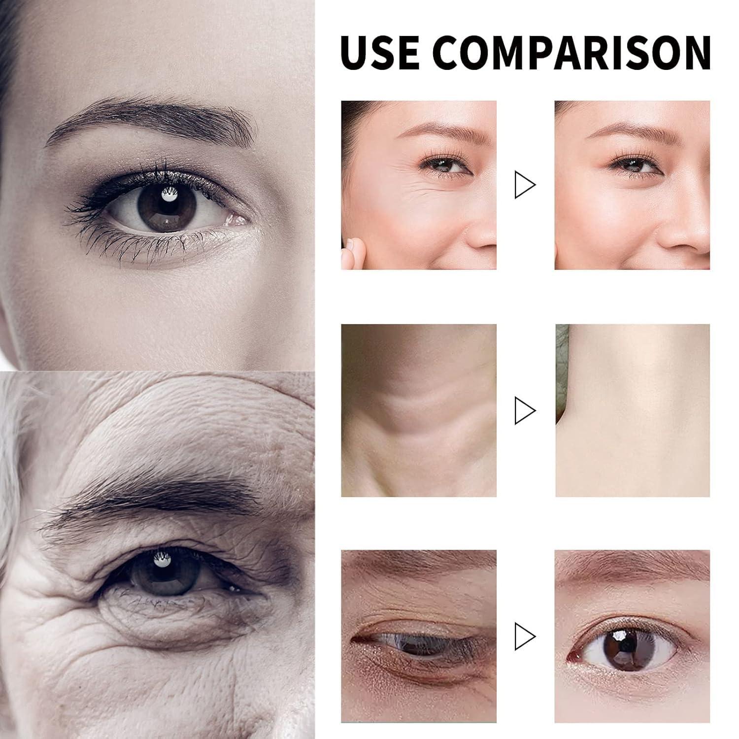 Regpem Qingling Face Cream, Qingling Crema Para Arrugas, Qingling Wrinkle Removal Cream, Polypeptide Tightening and Anti-Wrinkle Cream, Firming Anti-aging Eye Cream for Women Men (1)