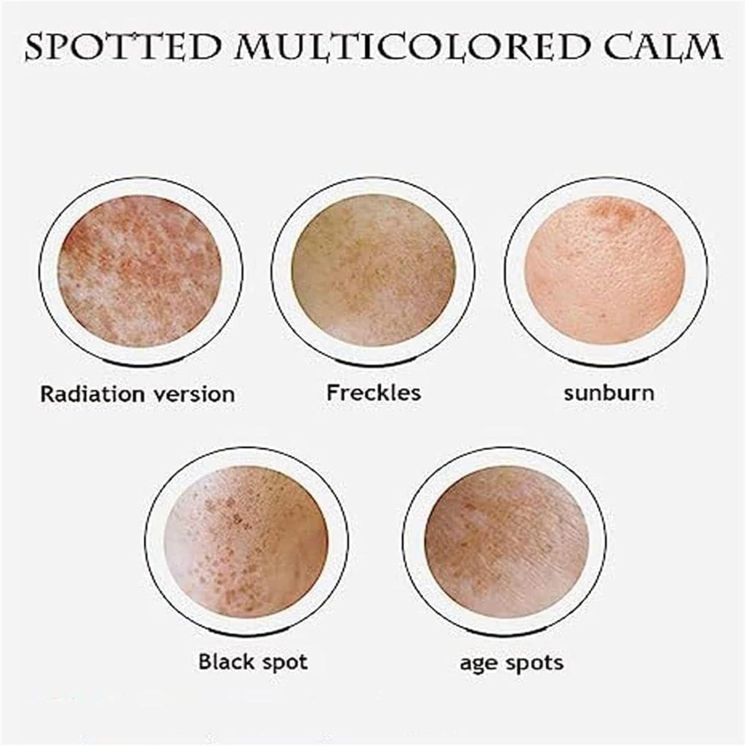 HEKEWER 2024 New Face Cream,Renewal Face Cream, Cosmetic Cream, Moisturizer Face Cream for Dry & Sensitive Skin (1PCS)