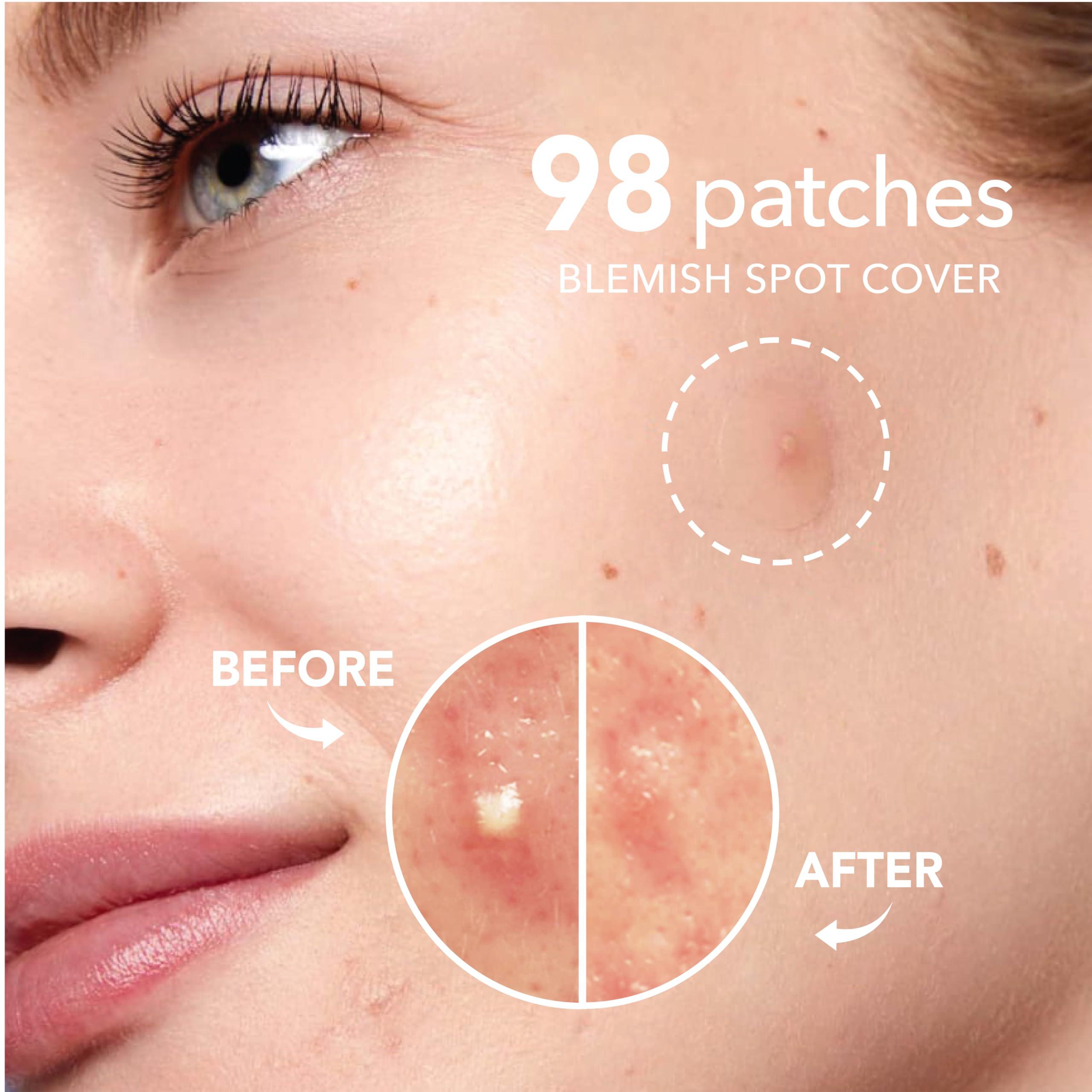 TADA BEAUTY TADA BEAUTY Incredible Blemish Patch - Hydrocolloid Pimple Patches Acne Patches for Face, Spot Treatment (2PK(196counts) Heart)