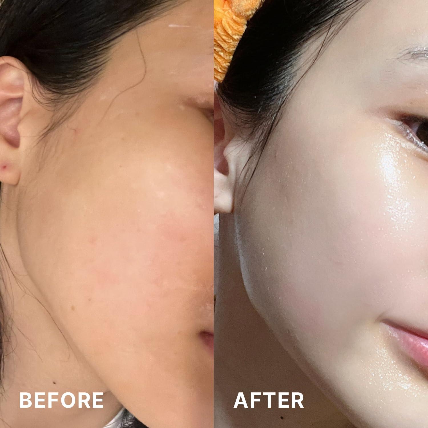 THOME THOME Program Action Mask Kit | 4-Step Facial Kit for Skin Care Routine | Hydrating, Nourishing & Skin Barrier Repair | Korean Skincare Kit for All Skin Types, Sensitive & Dry Skin (6 Sheets)