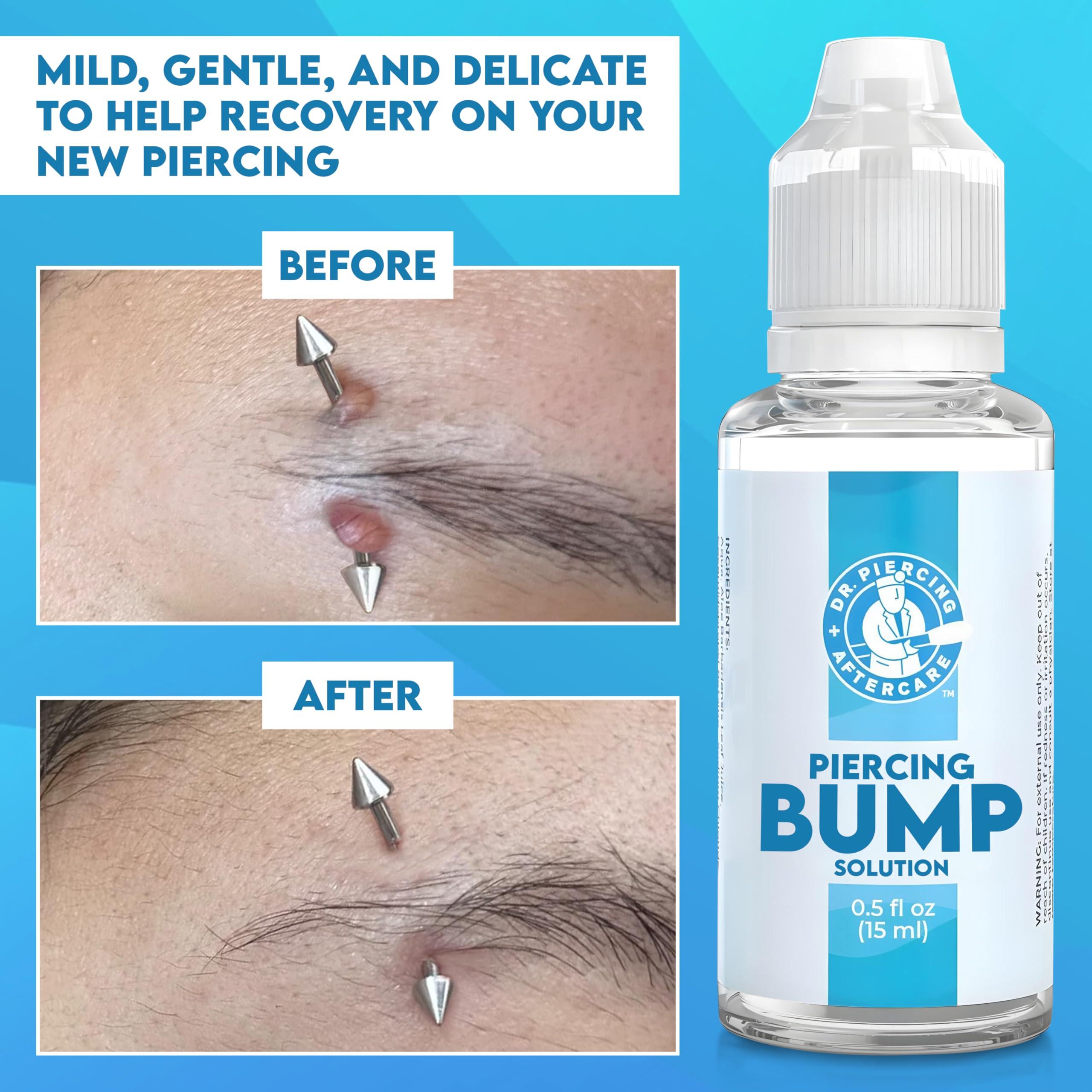 DR. PIERCING AFTERCARE Dr. Piercing Aftercare Keloid Drops Non-Greasy Saline Solution for Keloid Bump Removal for Piercings - Reduce Appearance of Nose Piercing Bump, Nose Ear Lip Belly (15 mL)