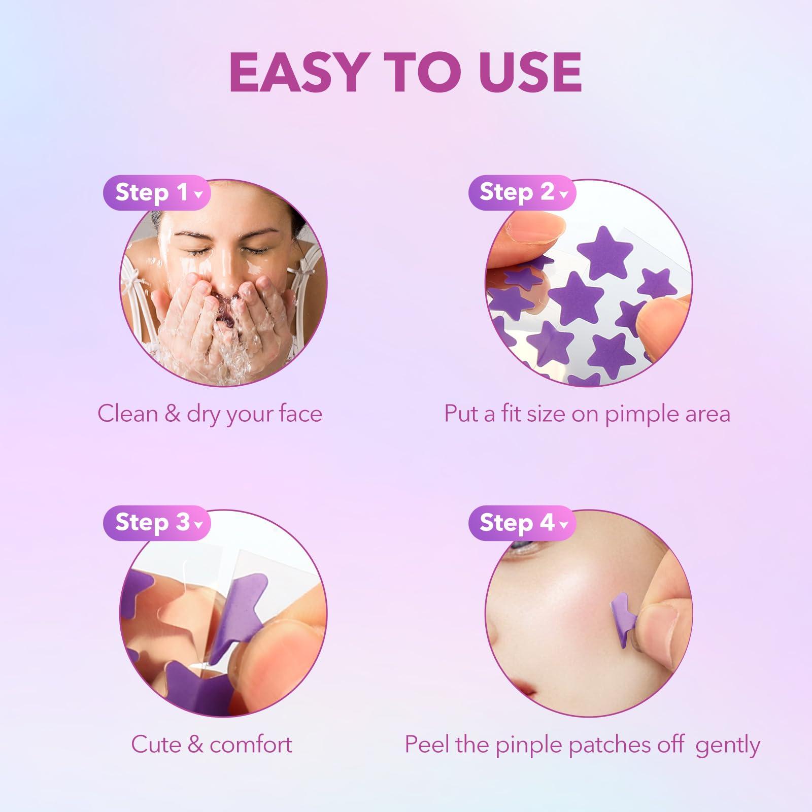 QUSTERE QUSTERE Pimple Patches for Face, Hydrocolloid Acne Patches, Cute Star Zit Covers for Face, Colorful Spot Stickers with Tea Tree, Salicylic Acid & Cica Oil| 3 Sizes (10mm, 12mm & 14mm) |280 Count