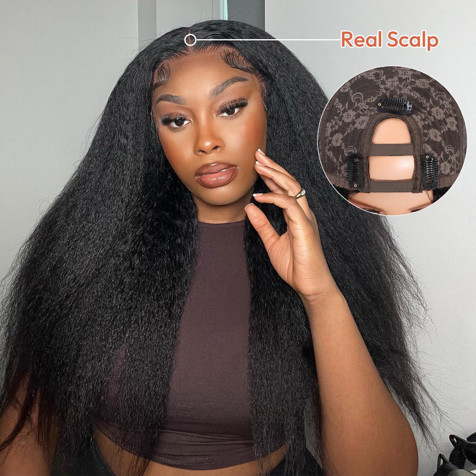 Dial Dial Antibacterial Bar Soap, White, 4 Ounce, 10 Bars