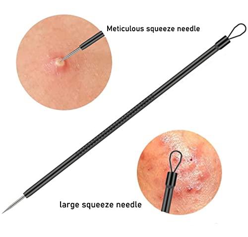 TULOBI Blackhead Remover Pimple Popper Tool Kit 4 Pcs Black Acne Comedone Zit Blackhead Extractor Tool for Nose Face,Stainless Steel Whitehead Popping Removal Tool Set