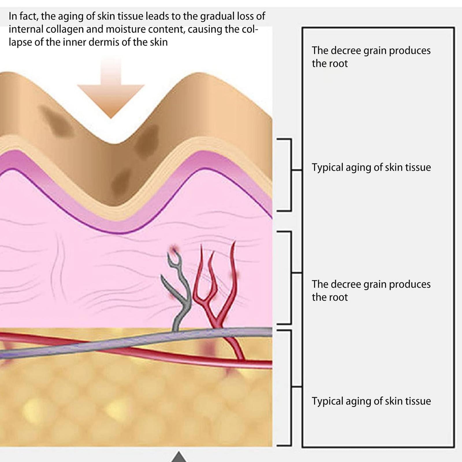 KRRHUEO Instant Beauty Face Nutrition Wrinkle Removal Lift Sticker,Hyaluronic Acid Microcrystalline Lifting Decree Patch,Strips For Face Wrinkles,Patch For All Skin Type (3box)