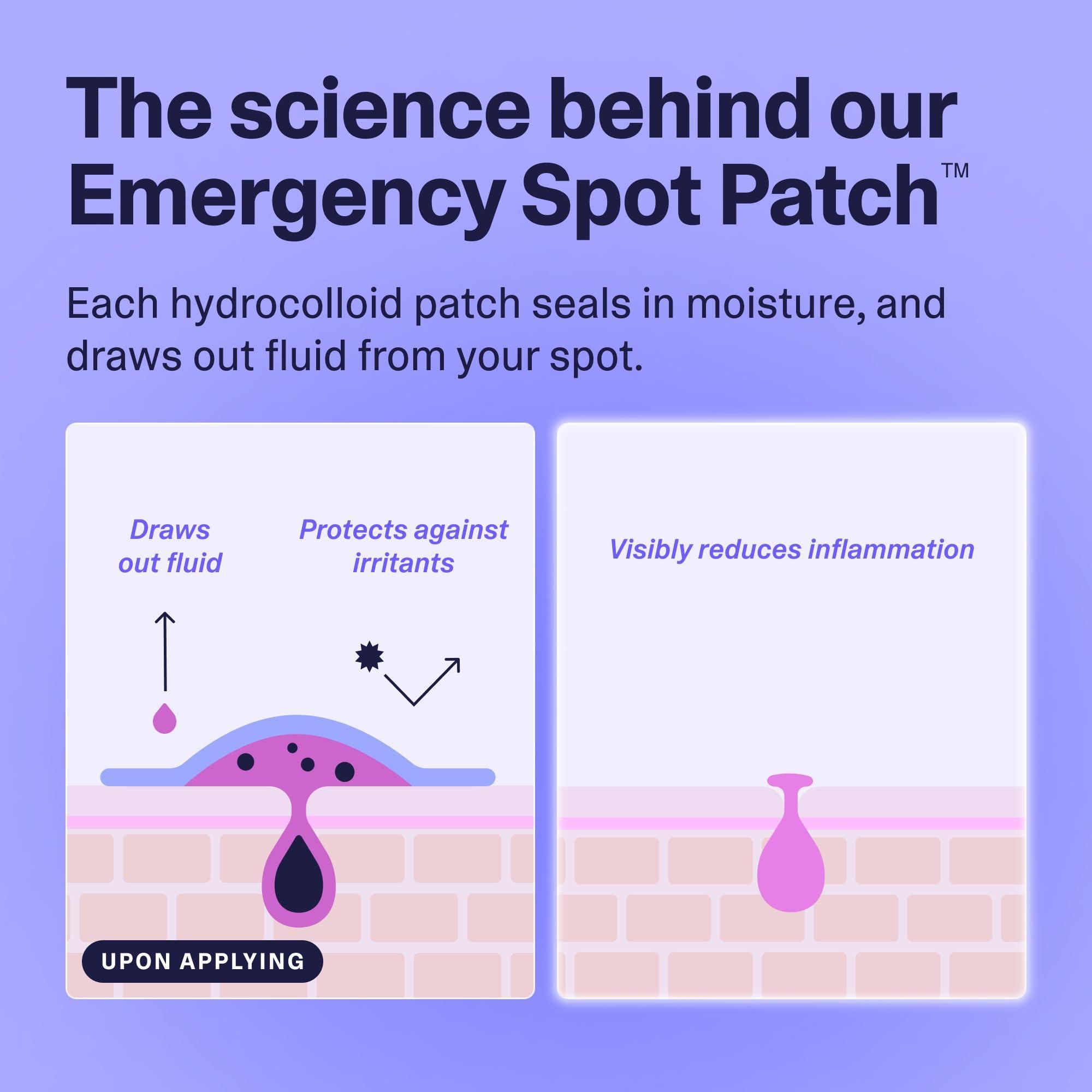 Curology Curology Emergency Spot Pimple Patches for Face, Hydrocolloid Pimple Patches Fast-Acting Support, Spot Concealing and Oil Absorbing, 40 Count