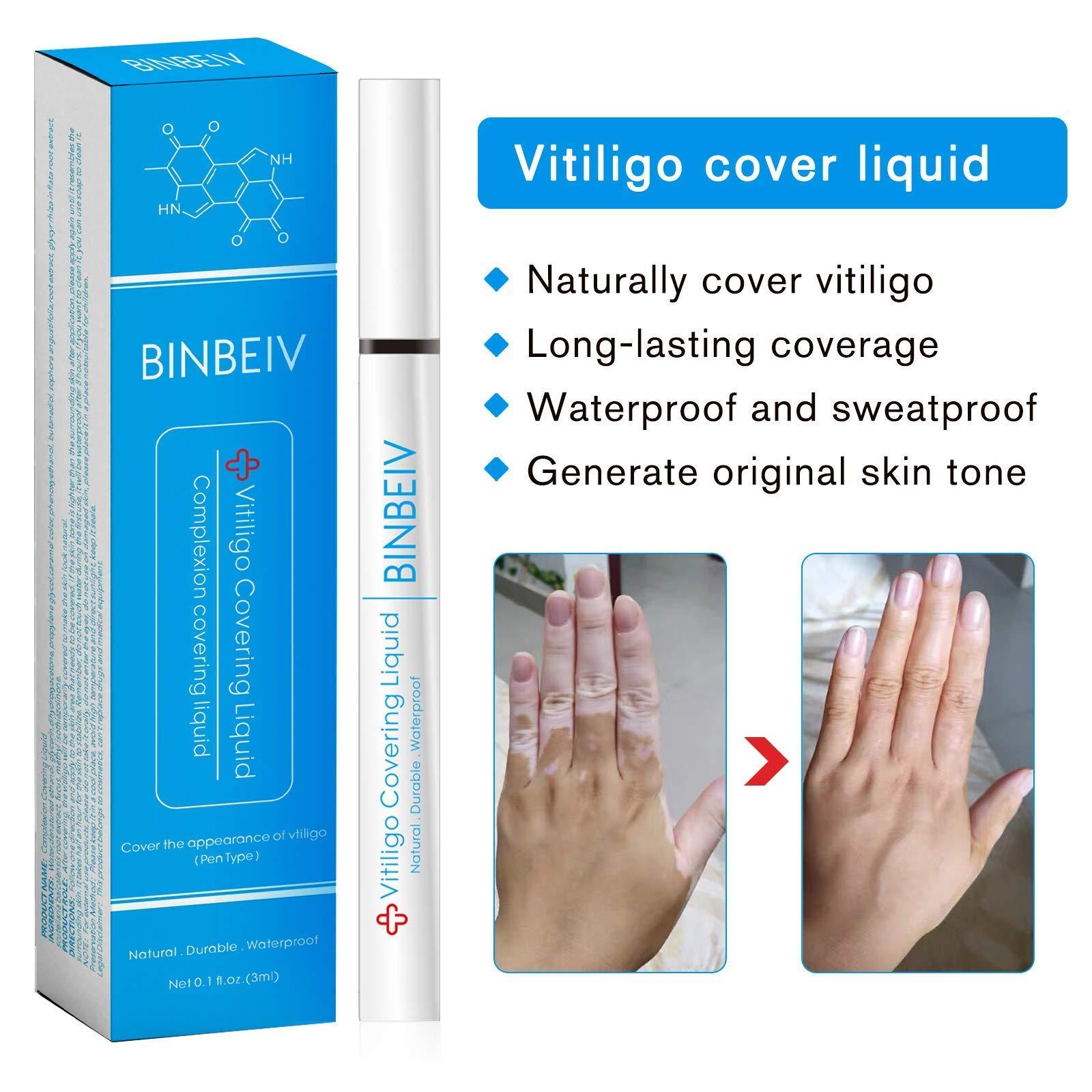 BINBEIV BINBEIV Vitiligo Cosmetic Camouflage Liqui, Cover appearance of Skin Depigmentation, Natural-Durable-Waterproof, Makeup Cover Waterproof, Used on face, hands and body
