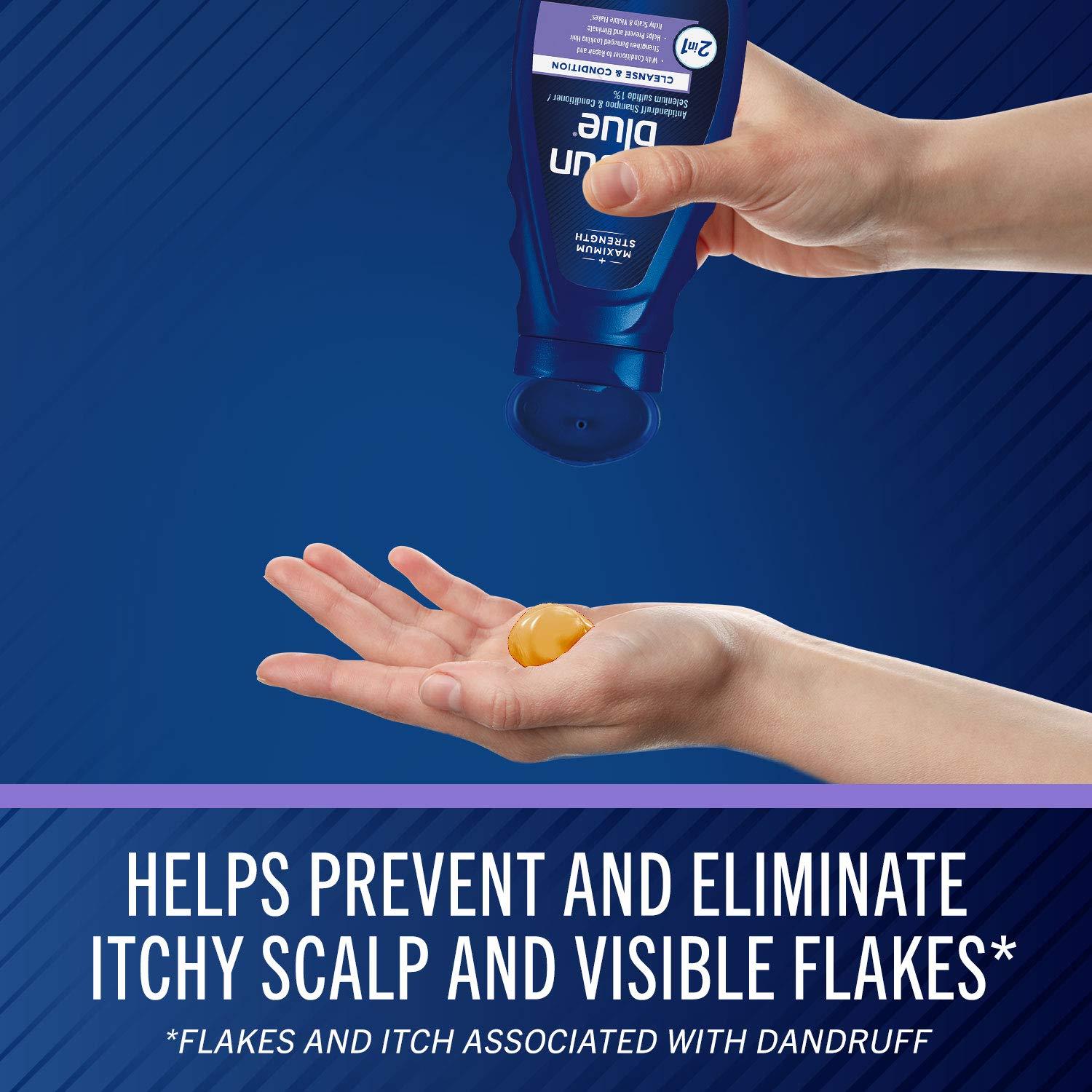 Selsun Blue Selsun Blue 2-in-1 Anti-dandruff Shampoo & Conditioner, 11 fl. oz., Maximum Strength 2-in-1 Treatment, Selenium Sulfide 1% (Pack of 2)