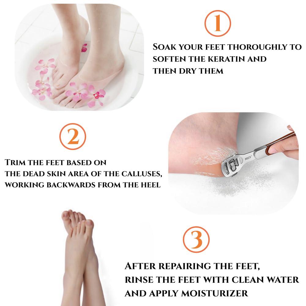 JRKOETY 2 Pack Pedicure Callus Shaver Set - Stainless Steel Foot File Callus Remover with 20pcs Blades and Plastic Handle,Foot Care Pedicure,Foot Callus Shaver Hard Skin Remover